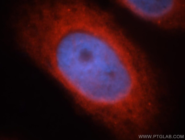 BRK Antibody in Immunocytochemistry (ICC/IF)