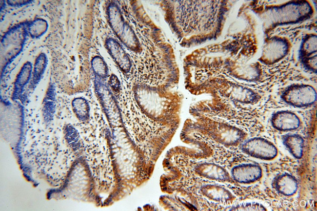 BRK Antibody in Immunohistochemistry (Paraffin) (IHC (P))