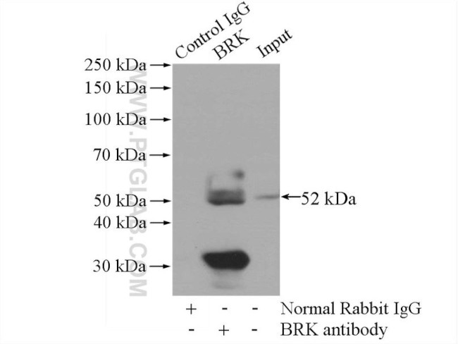 BRK Antibody in Immunoprecipitation (IP)