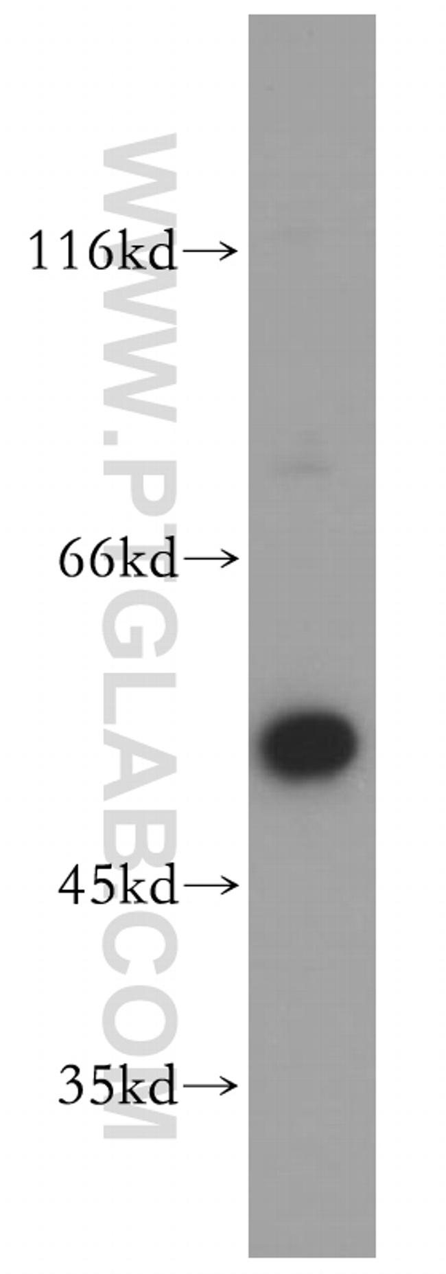 BRK Antibody in Western Blot (WB)