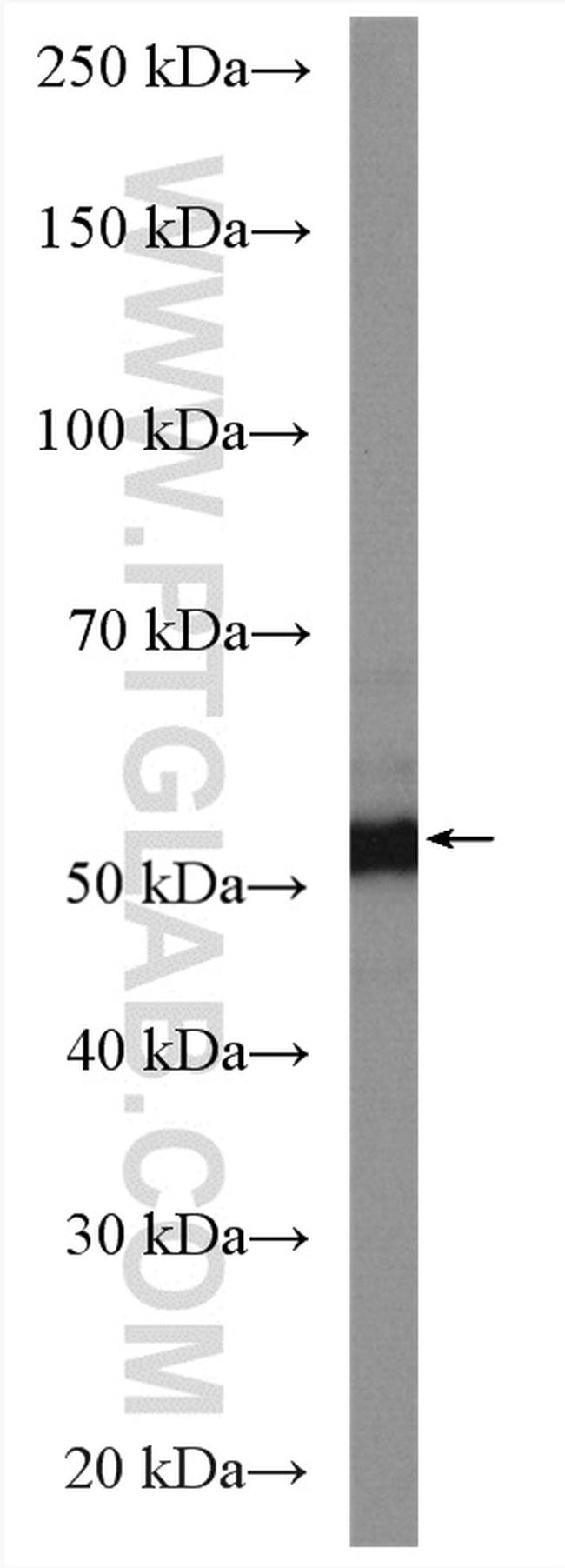 BRK Antibody in Western Blot (WB)