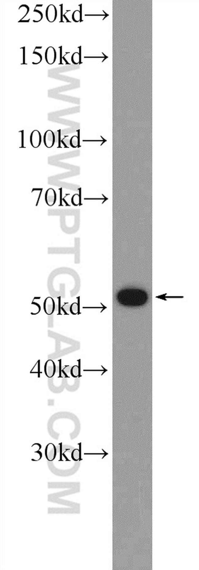 BRK Antibody in Western Blot (WB)