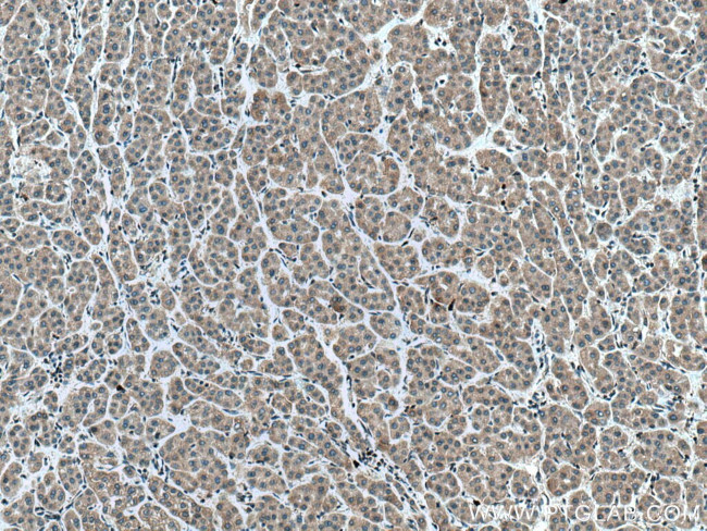 EPHA1 Antibody in Immunohistochemistry (Paraffin) (IHC (P))