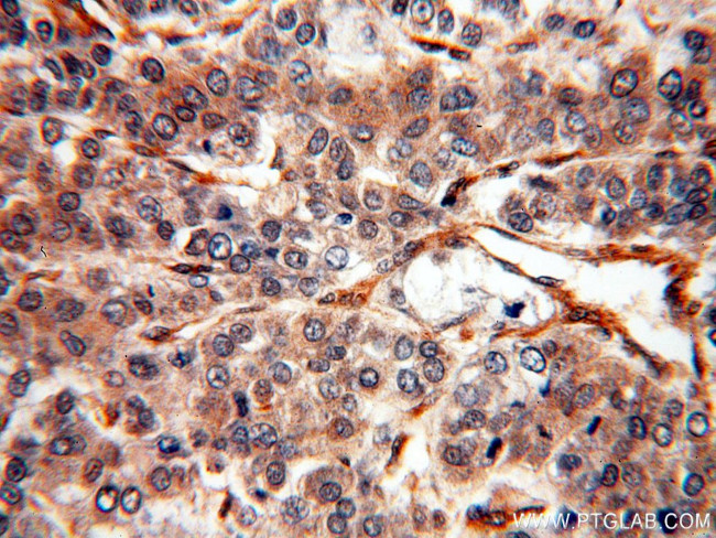 EPHA1 Antibody in Immunohistochemistry (Paraffin) (IHC (P))