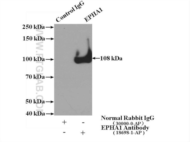 EPHA1 Antibody in Immunoprecipitation (IP)