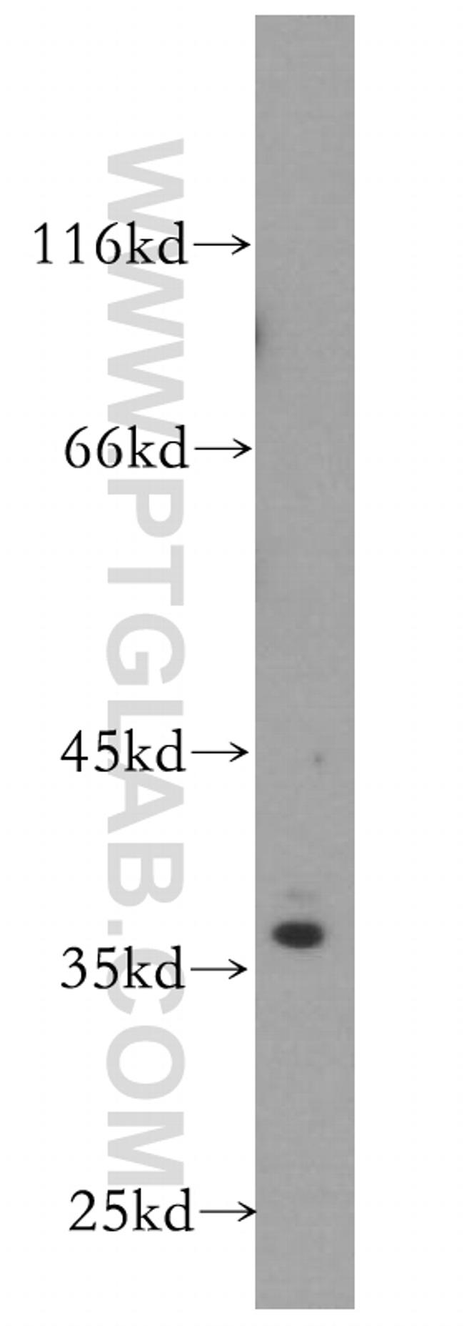 SRA1 Antibody in Western Blot (WB)