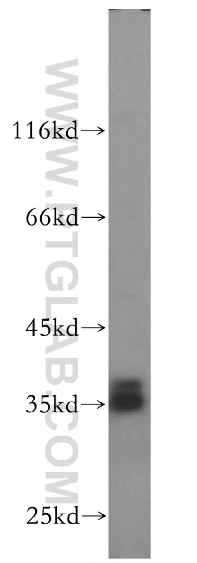 SRA1 Antibody in Western Blot (WB)