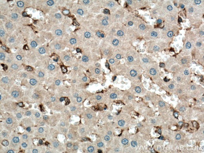 CD206 Antibody in Immunohistochemistry (Paraffin) (IHC (P))