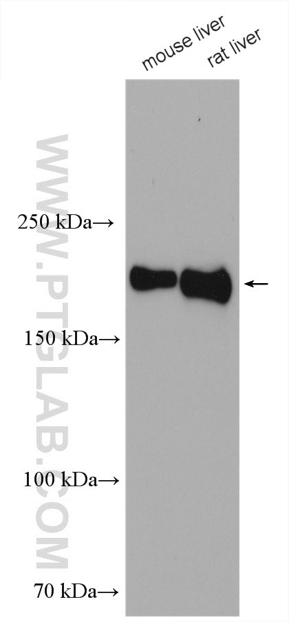 CD206 Antibody in Western Blot (WB)