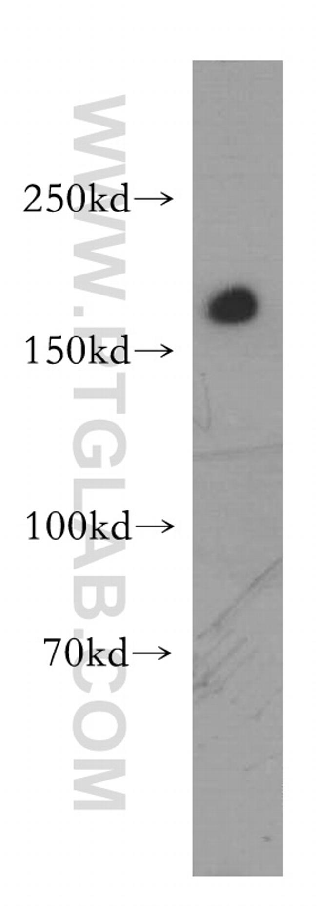 CD206 Antibody in Western Blot (WB)