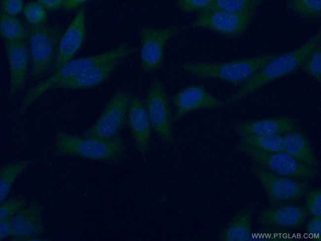 RIC8A Antibody in Immunocytochemistry (ICC/IF)