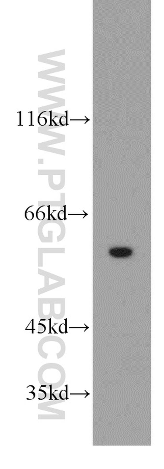 RIC8A Antibody in Western Blot (WB)