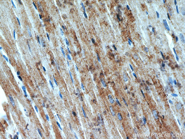 CKM Antibody in Immunohistochemistry (Paraffin) (IHC (P))