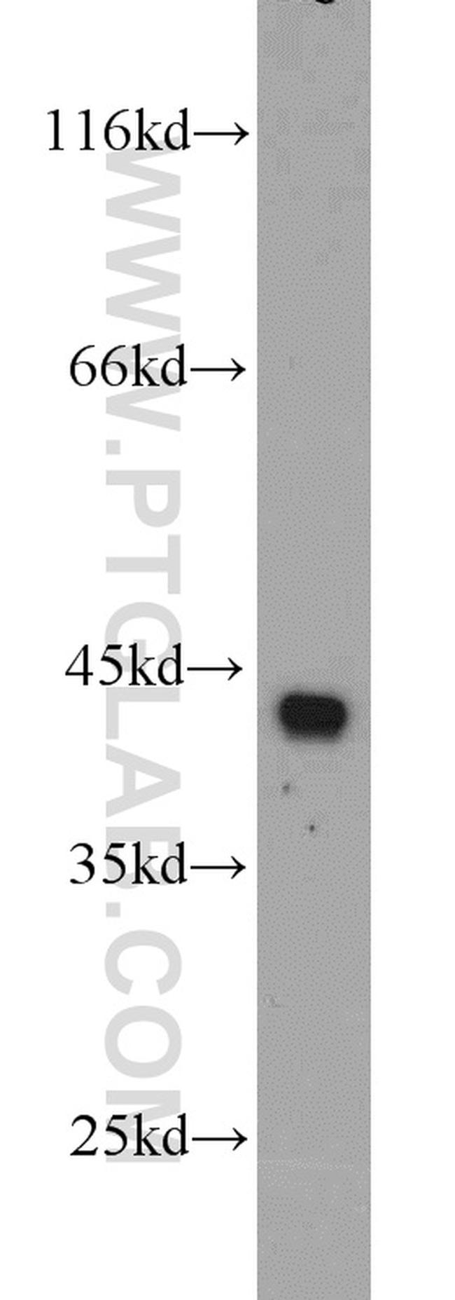 CKM Antibody in Western Blot (WB)