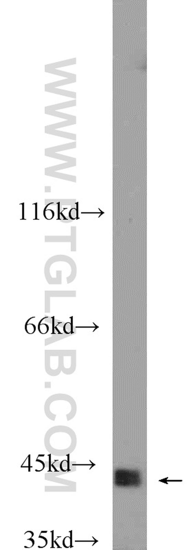 CKM Antibody in Western Blot (WB)