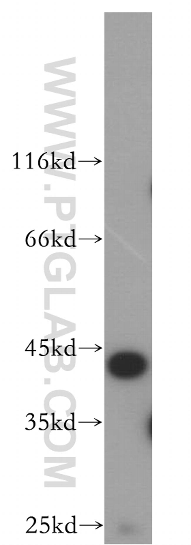 CKM Antibody in Western Blot (WB)