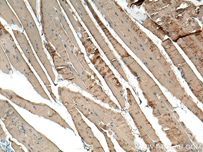 CKM Antibody in Immunohistochemistry (Paraffin) (IHC (P))