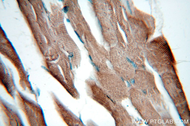 CKM Antibody in Immunohistochemistry (Paraffin) (IHC (P))