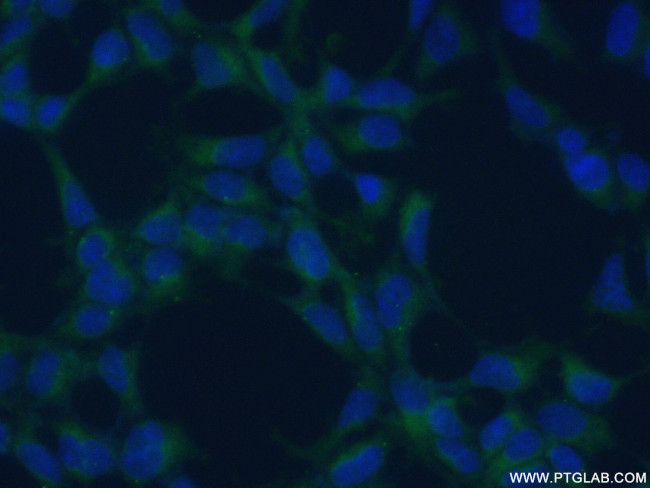 Creatine kinase B type Antibody in Immunocytochemistry (ICC/IF)