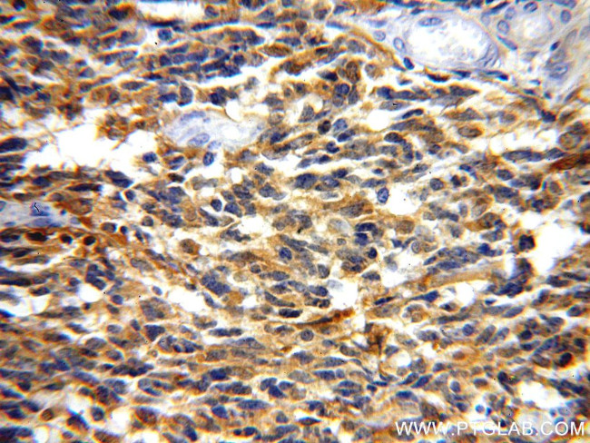 Creatine kinase B type Antibody in Immunohistochemistry (Paraffin) (IHC (P))