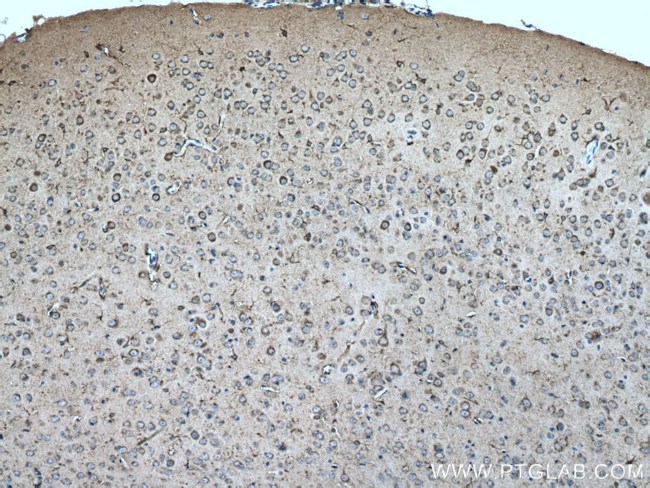 Creatine kinase B type Antibody in Immunohistochemistry (Paraffin) (IHC (P))