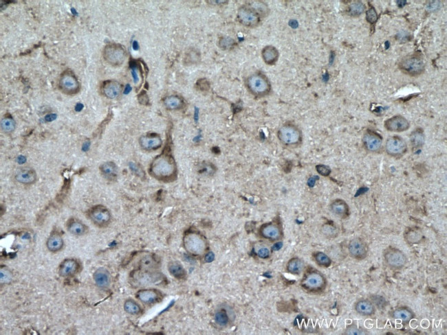 Creatine kinase B type Antibody in Immunohistochemistry (Paraffin) (IHC (P))