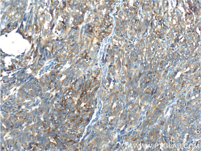 Creatine kinase B type Antibody in Immunohistochemistry (Paraffin) (IHC (P))