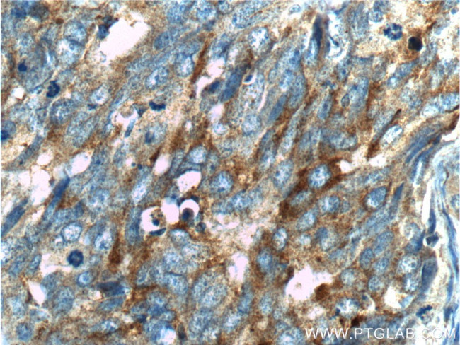 Creatine kinase B type Antibody in Immunohistochemistry (Paraffin) (IHC (P))