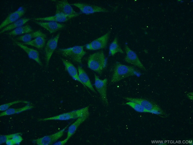 VWA2 Antibody in Immunocytochemistry (ICC/IF)