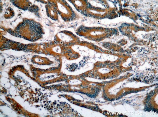 VWA2 Antibody in Immunohistochemistry (Paraffin) (IHC (P))