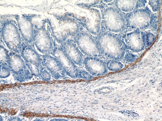 VWA2 Antibody in Immunohistochemistry (Paraffin) (IHC (P))