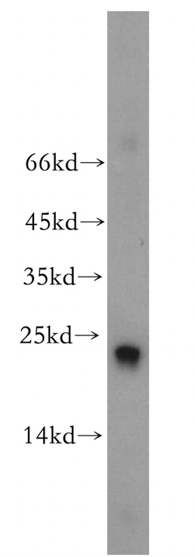 RAB9A Antibody in Western Blot (WB)