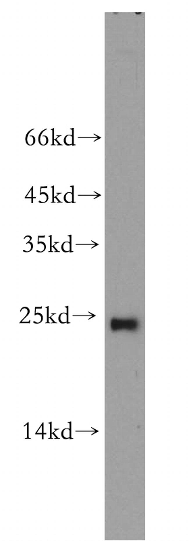 RAB9A Antibody in Western Blot (WB)