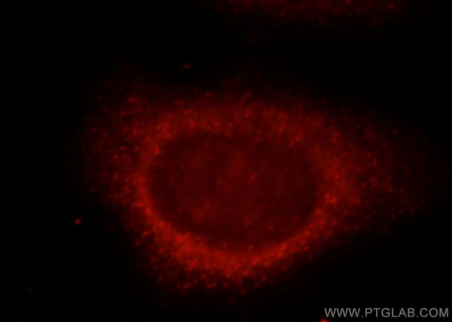 LC3A Antibody in Immunocytochemistry (ICC/IF)