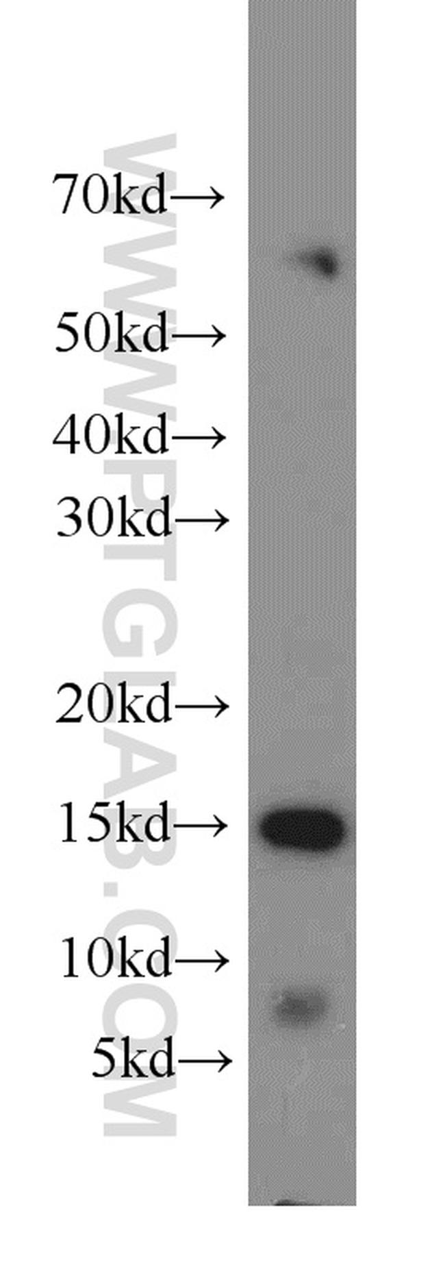 LC3A Antibody in Western Blot (WB)