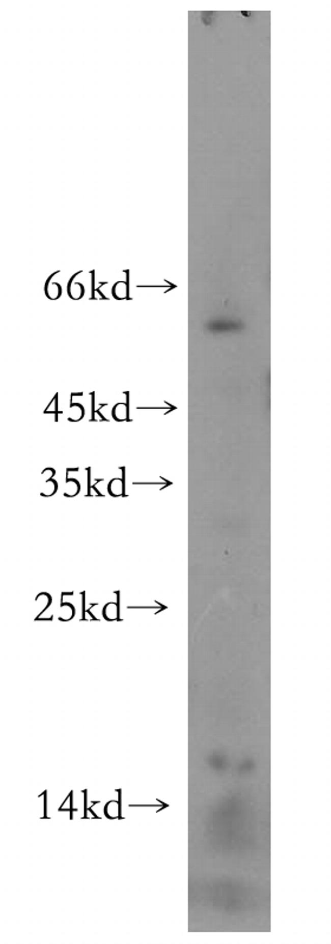 LC3A Antibody in Western Blot (WB)