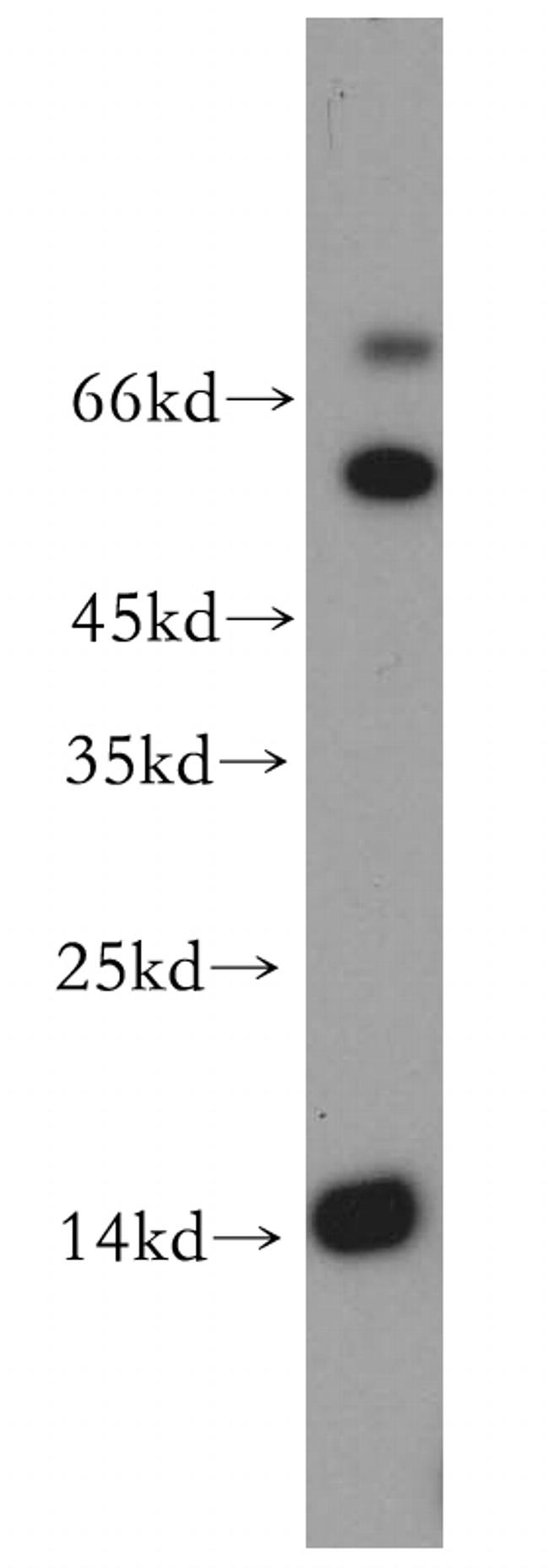 LC3A Antibody in Western Blot (WB)