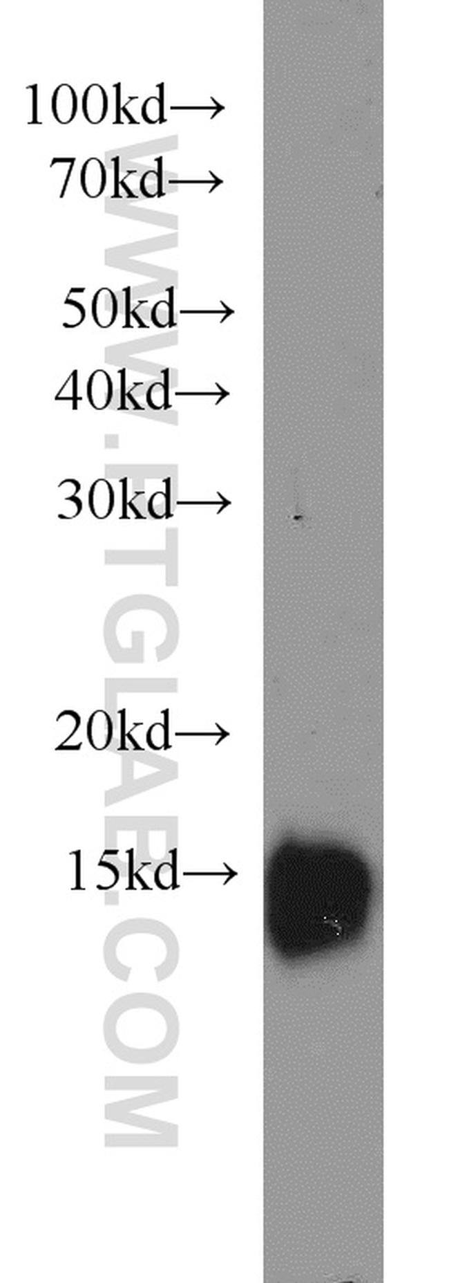 GABARAP Antibody in Western Blot (WB)