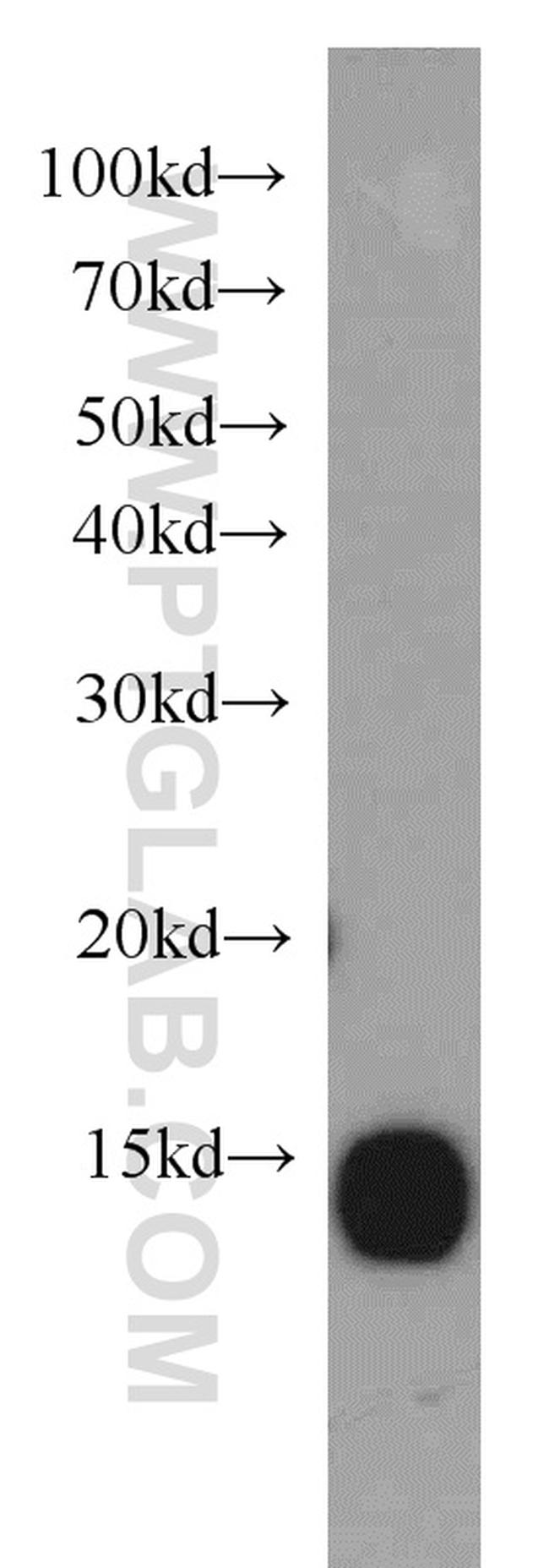 GABARAP Antibody in Western Blot (WB)