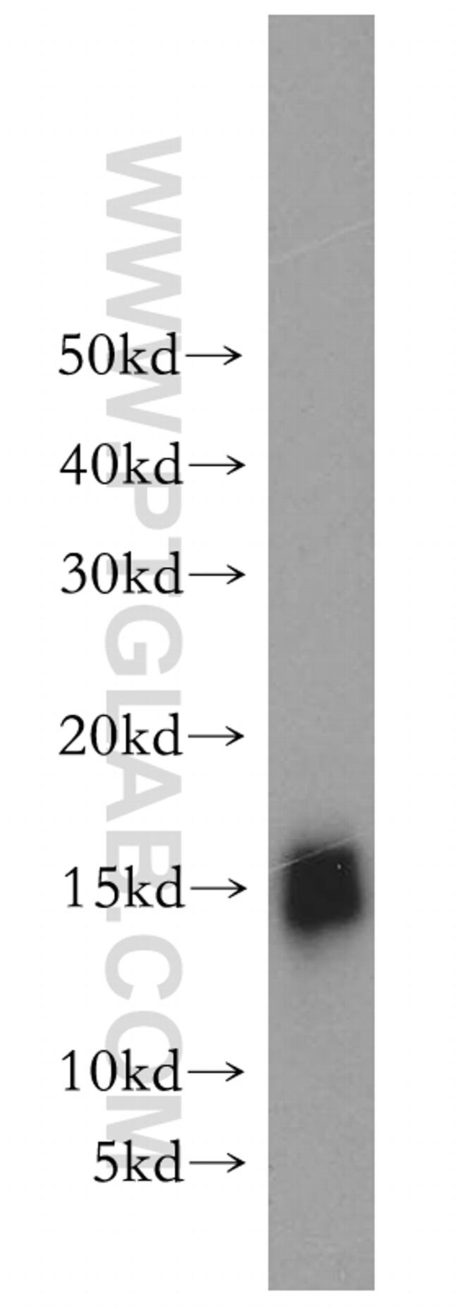 GABARAP Antibody in Western Blot (WB)