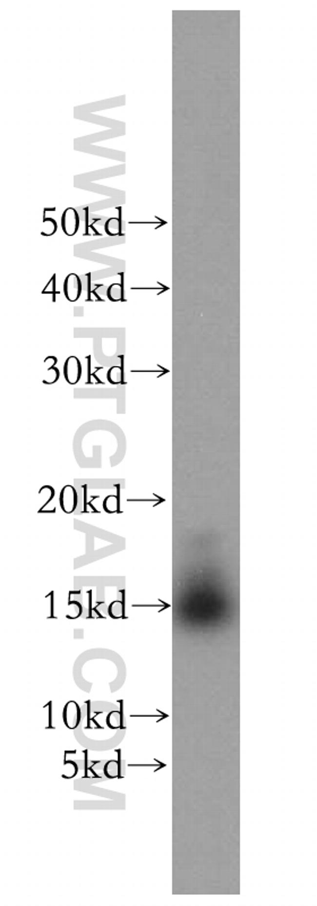 GABARAP Antibody in Western Blot (WB)