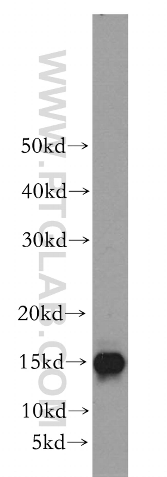 GABARAP Antibody in Western Blot (WB)