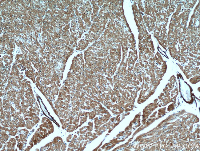 GABARAPL2 Antibody in Immunohistochemistry (Paraffin) (IHC (P))