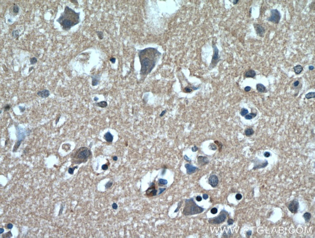 GABARAPL2 Antibody in Immunohistochemistry (Paraffin) (IHC (P))