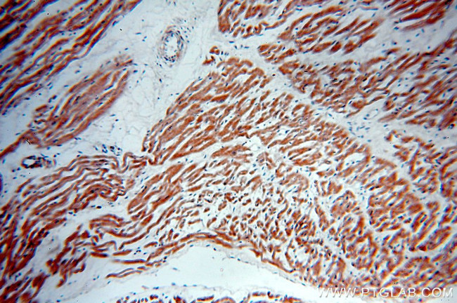 GABARAPL2 Antibody in Immunohistochemistry (Paraffin) (IHC (P))