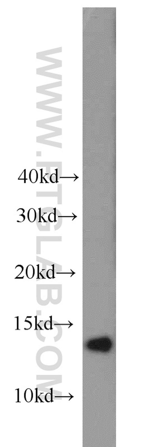 GABARAPL2 Antibody in Western Blot (WB)