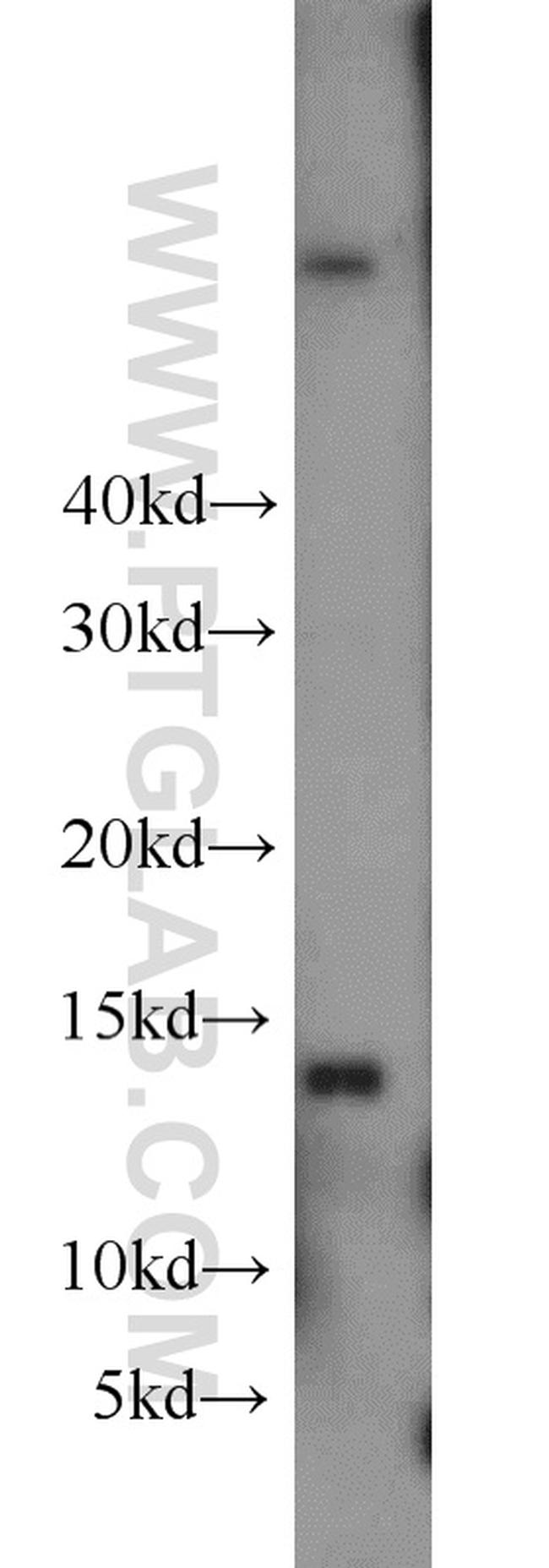 GABARAPL2 Antibody in Western Blot (WB)