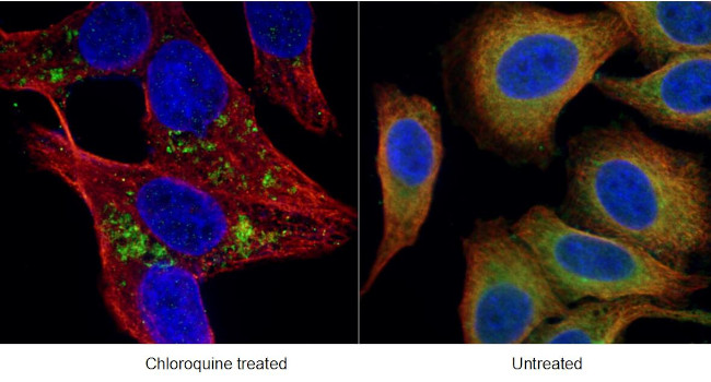 LC3B Antibody in Immunocytochemistry (ICC/IF)