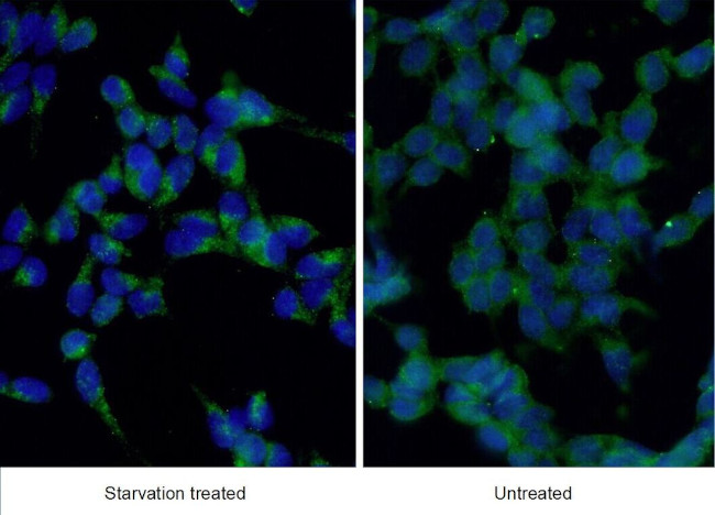 LC3B Antibody in Immunocytochemistry (ICC/IF)