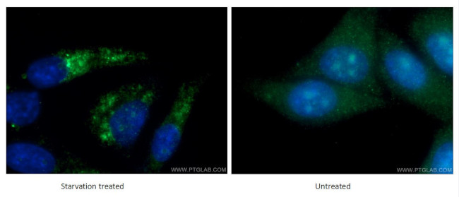 LC3B Antibody in Immunocytochemistry (ICC/IF)